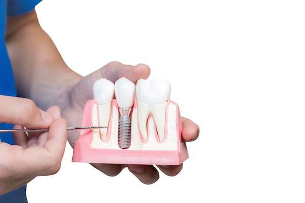 Can You Get Dental Implants if You Have Gum Disease from Signature Smiles of Park Ridge in Park Ridge, IL