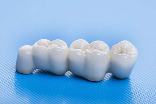 How Many Teeth Can Dental Bridges Replace from Signature Smiles of Park Ridge in Park Ridge, IL