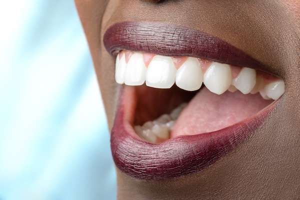 Routine Dental Care: What Are Tooth Colored Fillings from Signature Smiles of Park Ridge in Park Ridge, IL